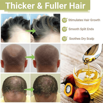 Floré Haircare Batana Oil 118ml | Pure Batana Oil for Hair Growth, Thinning Hair, Scalp Nourishment & Shine | 100% Natural, Paraben-Free, Vegan - Floré Haircare 