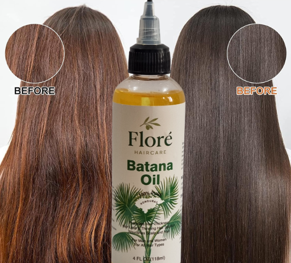 Floré Haircare Batana Oil 118ml | Pure Batana Oil for Hair Growth, Thinning Hair, Scalp Nourishment & Shine | 100% Natural, Paraben-Free, Vegan - Floré Haircare 