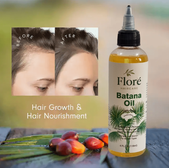 Floré Haircare Batana Oil 118ml | Pure Batana Oil for Hair Growth, Thinning Hair, Scalp Nourishment & Shine | 100% Natural, Paraben-Free, Vegan - Floré Haircare 